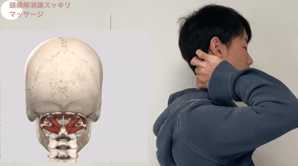 【頭痛解消】頭が冴え渡る!後頭下筋のリリース 1 【頭痛解消】頭が冴え渡る!後頭下筋のリリース